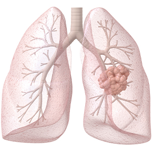 drawing of healthy lungs