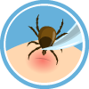 Illustration of tick on skin, being removed by tweezers